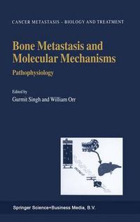 Cover image for Bone Metastasis and Molecular Mechanisms: Pathophysiology