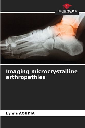 Cover image for Imaging microcrystalline arthropathies