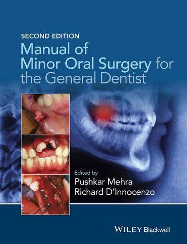 Cover image for Manual of Minor Oral Surgery for the General Dentist 2e