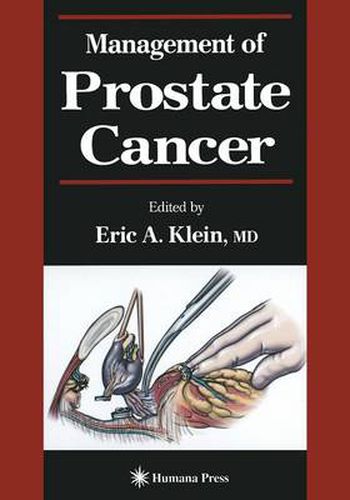 Cover image for Management of Prostate Cancer