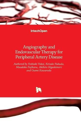 Cover image for Angiography and Endovascular Therapy for Peripheral Artery Disease