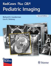 Cover image for RadCases Plus Q&A Pediatric Imaging