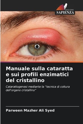 Cover image for Manuale sulla cataratta e sui profili enzimatici del cristallino