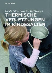 Cover image for Thermische Verletzungen im Kindesalter