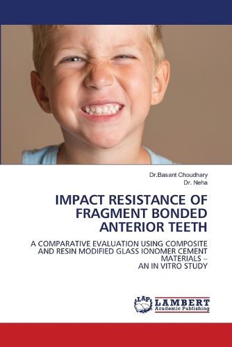 Cover image for Impact Resistance of Fragment Bonded Anterior Teeth