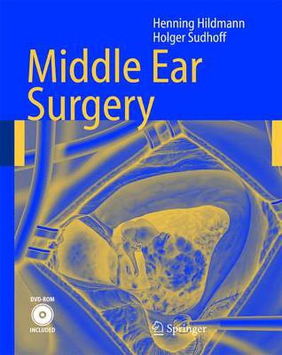 Cover image for Middle Ear Surgery