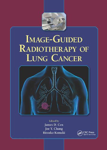 Cover image for Image-Guided Radiotherapy of Lung Cancer