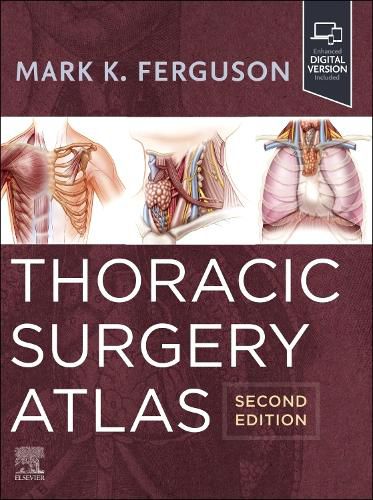 Cover image for Thoracic Surgery Atlas