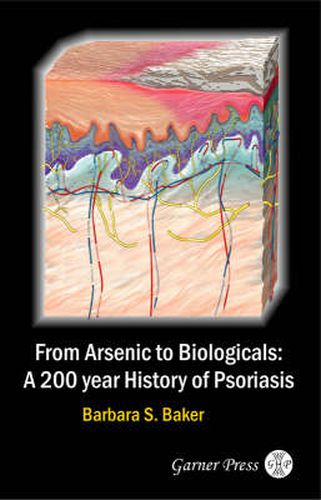 Cover image for From Arsenic to Biologicals: A 200 Year History of Psoriasis