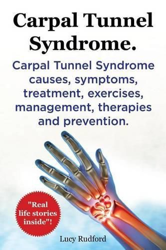 Cover image for Carpal Tunnel Syndrome. Carpal Tunnel Syndrome causes, symptoms, treatment, exercises, management, therapies and prevention. Real Life Stories Inside!.