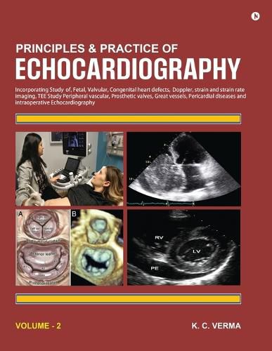 Cover image for Principles and Practice of Echocardiography Volume 2