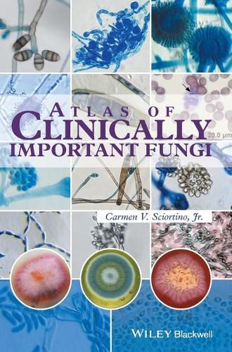Cover image for Atlas of Clinically Important Fungi
