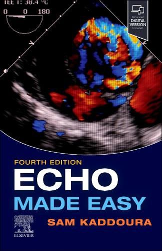 Cover image for Echo Made Easy