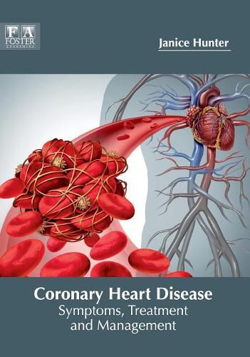 Cover image for Coronary Heart Disease: Symptoms, Treatment and Management