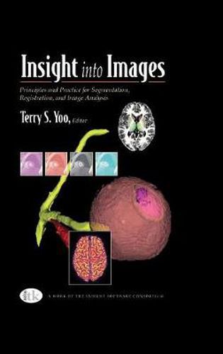 Cover image for Insight into Images: Principles and Practice for Segmentation, Registration, and Image Analysis