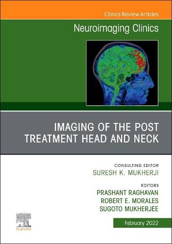 Cover image for Imaging of the Post Treatment Head and Neck, An Issue of Neuroimaging Clinics of North America