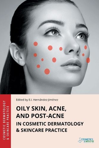 Cover image for Oily Skin, Acne, and Post-Acne in Cosmetic Dermatology & Skincare Practice