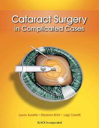 Cover image for Cataract Surgery in Complicated Cases