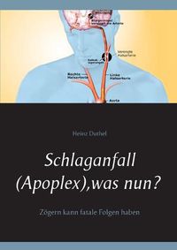 Cover image for Schlaganfall (Apoplex), was nun?: Zoegern kann fatale Folgen haben