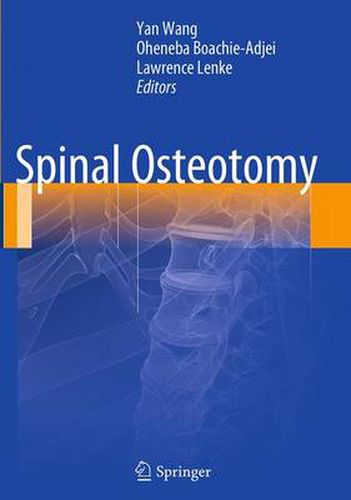 Cover image for Spinal Osteotomy