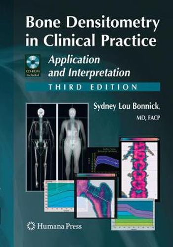 Cover image for Bone Densitometry in Clinical Practice: Application and Interpretation