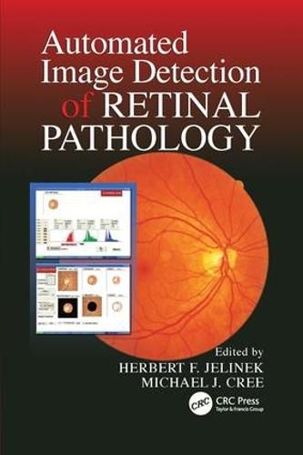 Cover image for Automated Image Detection of Retinal Pathology