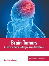 Cover image for Brain Tumors: A Practical Guide to Diagnosis and Treatment