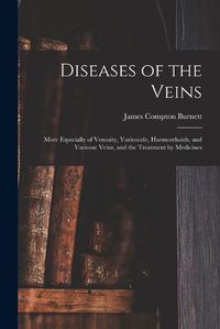 Cover image for Diseases of the Veins