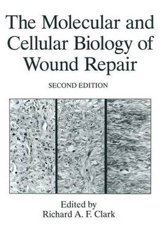 Cover image for The Molecular and Cellular Biology of Wound Repair