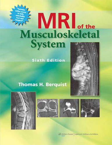 Cover image for MRI of the Musculoskeletal System