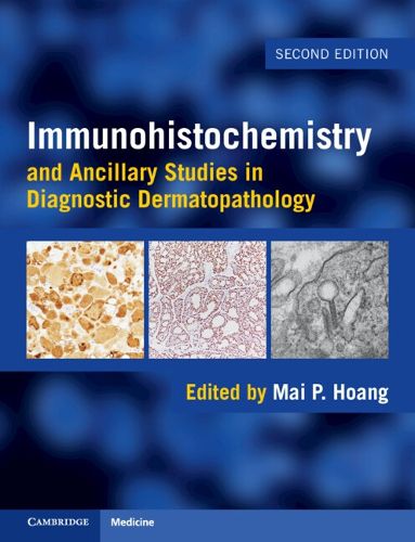 Cover image for Immunohistochemistry and Ancillary Studies in Diagnostic Dermatopathology