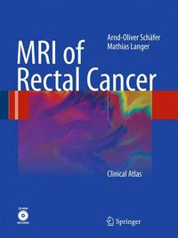 Cover image for MRI of Rectal Cancer: Clinical Atlas