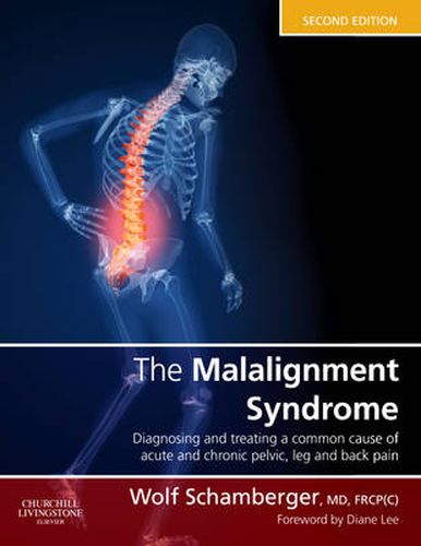 Cover image for The Malalignment Syndrome: diagnosis and treatment of common pelvic and back pain