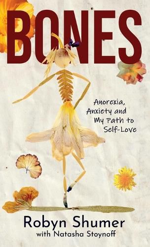 Cover image for Bones