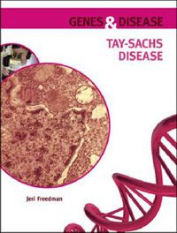 Cover image for Tay-Sachs Disease