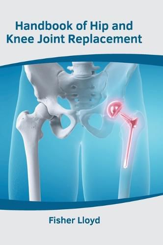 Cover image for Handbook of Hip and Knee Joint Replacement