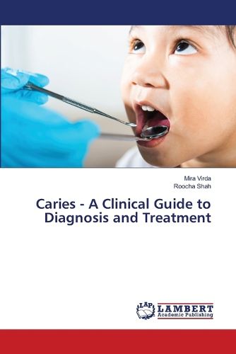 Cover image for Caries - A Clinical Guide to Diagnosis and Treatment