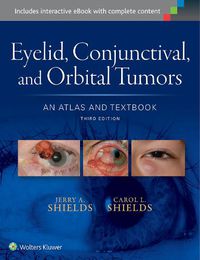 Cover image for Eyelid, Conjunctival, and Orbital Tumors: An Atlas and Textbook
