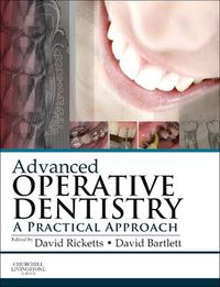 Cover image for Advanced Operative Dentistry: A Practical Approach