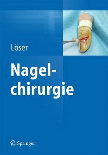 Cover image for Nagelchirurgie