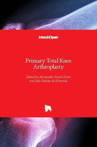 Cover image for Primary Total Knee Arthroplasty