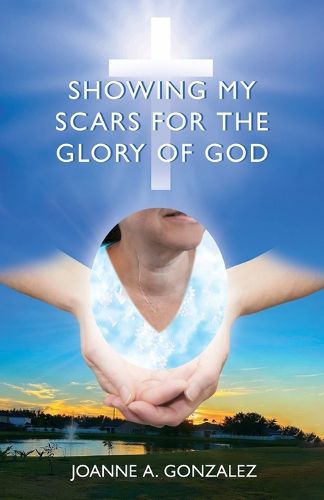 Cover image for Showing My Scars for the Glory of God