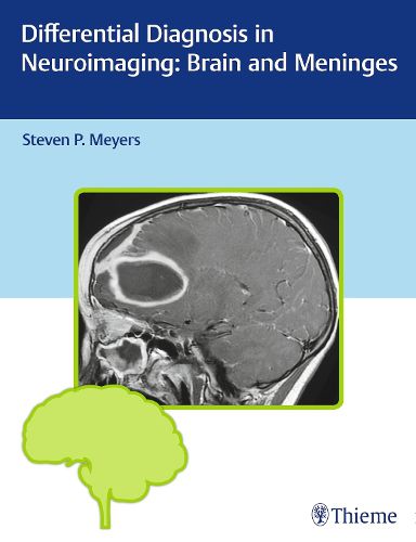 Cover image for Differential Diagnosis in Neuroimaging: Brain and Meninges