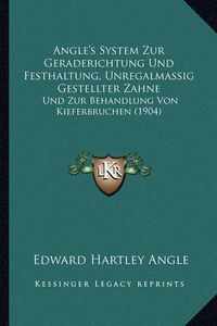 Cover image for Angle's System Zur Geraderichtung Und Festhaltung, Unregalmassig Gestellter Zahne: Und Zur Behandlung Von Kieferbruchen (1904)