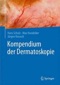 Cover image for Kompendium der Dermatoskopie