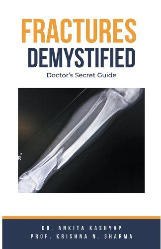 Cover image for Fractures Demystified