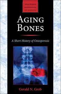 Cover image for Aging Bones: A Short History of Osteoporosis