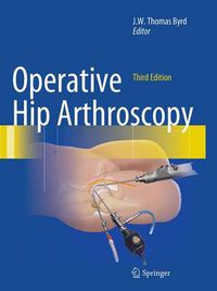 Cover image for Operative Hip Arthroscopy