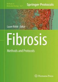 Cover image for Fibrosis: Methods and Protocols