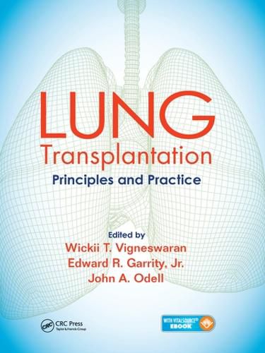 LUNG Transplantation: Principles and Practice